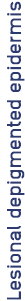 Lesional_depigmented_epidermis